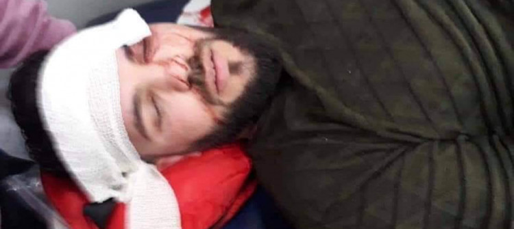 صحافي إصابته بليغة<br> موكب محافظ نينوى يدهس الإعلاميين ويصيبهم بجروح